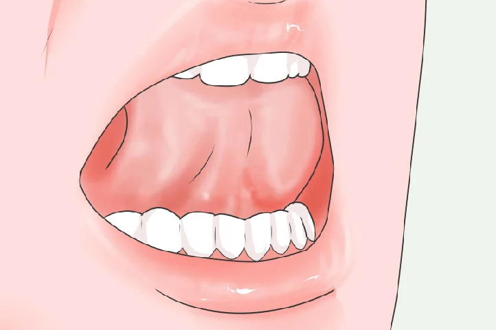What Does Mewing Mean Slang?